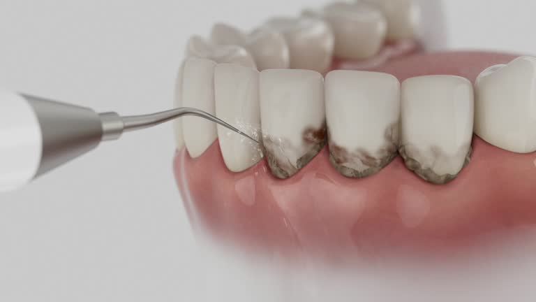 Reliable Root Canal Treatment contractor in Summers County County, WV by Dentist Open Now